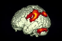 Найти лжеца поможет сканирование головного мозга