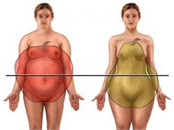 Ученые опровергли связь типов ожирения с риском инфаркта