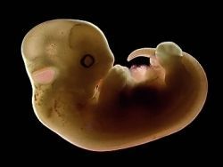 Эмбрион в утробе матери и плачет, и смеется