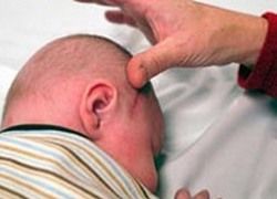 Младенец со ступней в голове стал научной сенсацией