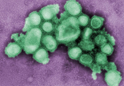 ВОЗ: Угроза пандемии гриппа H1N1 сохраняется