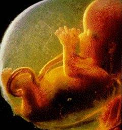 Впервые в истории эмбриону поставлен кардиостимулятор