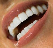 Ученые: Отбеливание зубов может привести к ожогам
