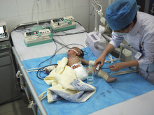 В Индонезии родилась девочка с восемью конечностями